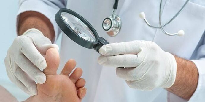 O médico examina o pé de um paciente com um pico com uma lupa